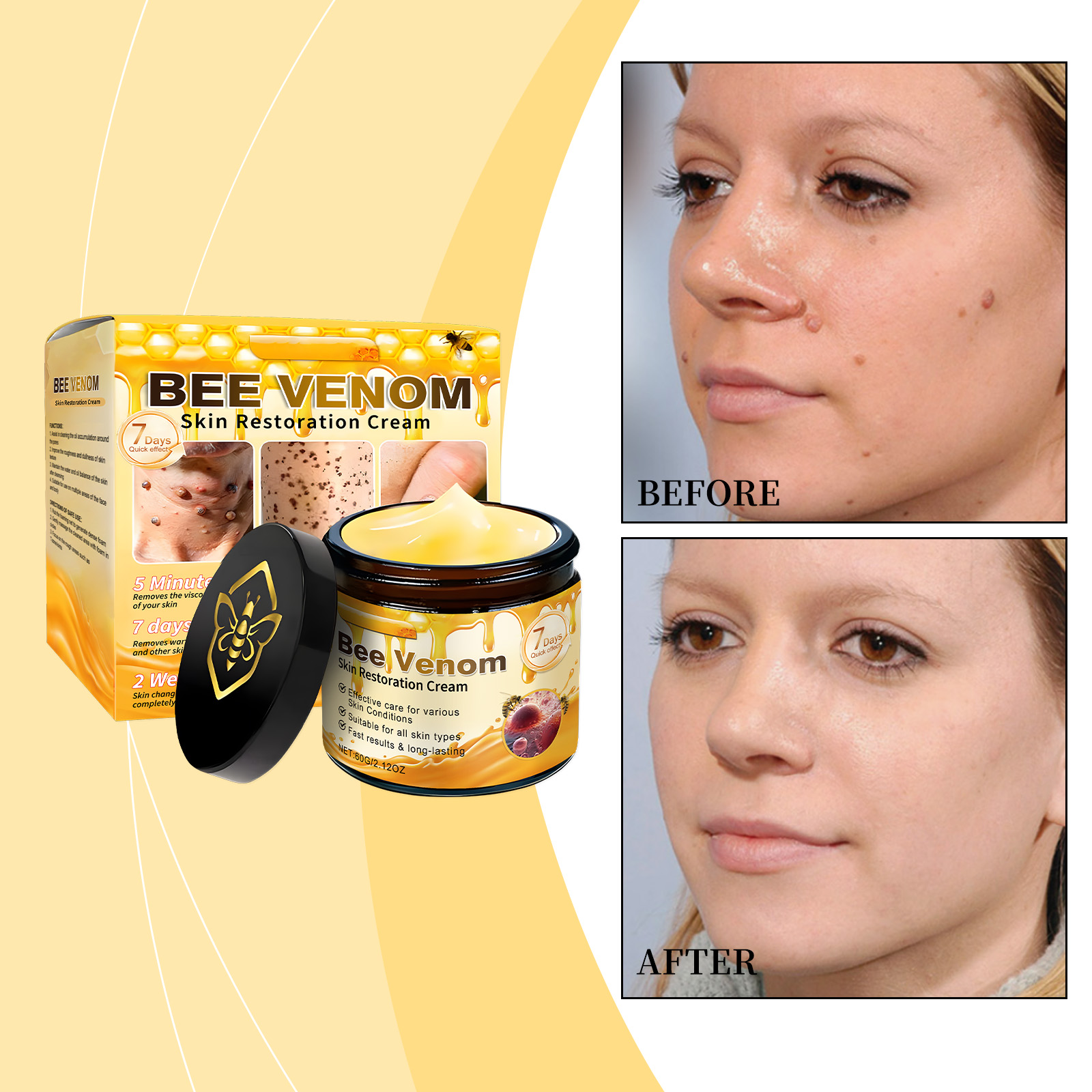 Skin Soothing Cream 60g 1box photo 2