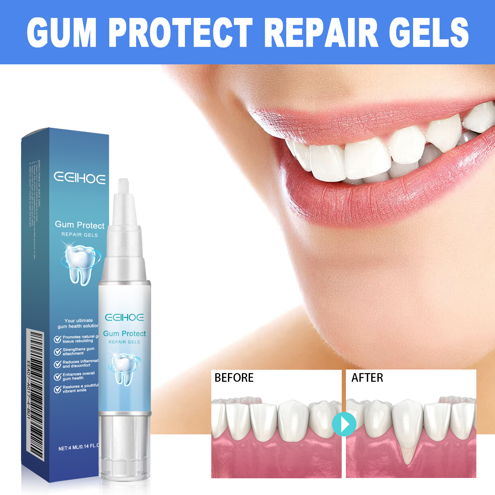 Dental Soothing Gel 4ml 1box photo 4