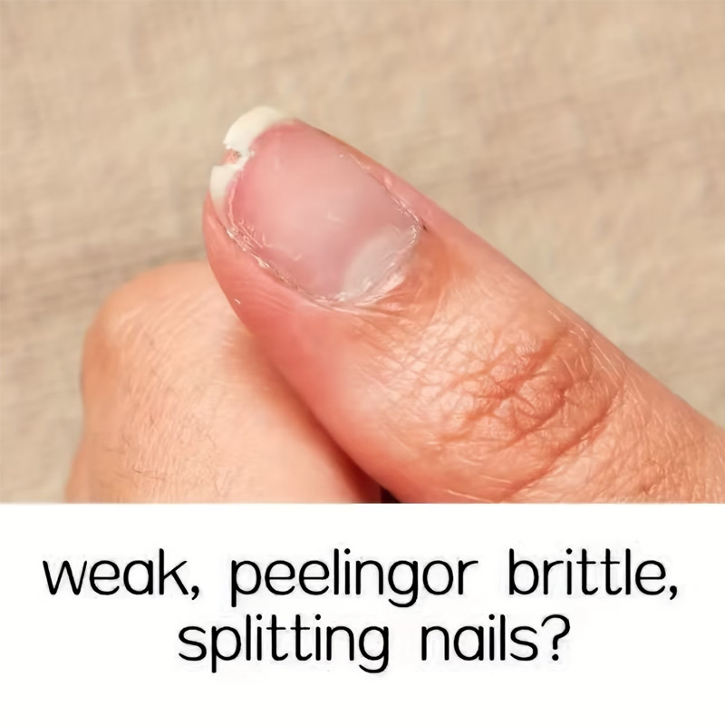 Strengthening And Cracked Nail Bed Nourishing Serum photo 5
